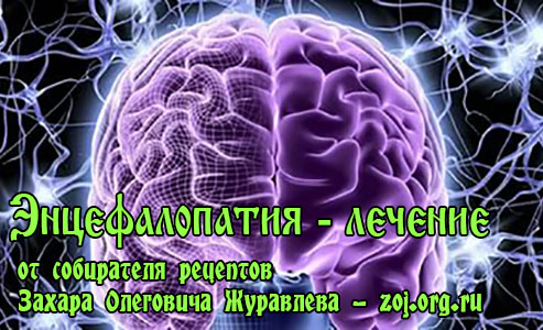 Дисциркуляторная энцефалопатия головного мозга