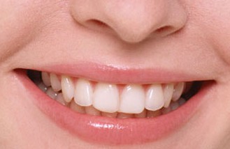 Улыбка и здоровые зубы